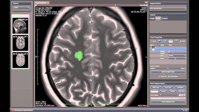 MedInria, how to secure records MedInria, export and migration tutorial with rollback planning