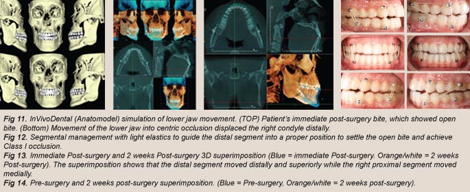 InVivoDental Viewer (Lite), how to set up InVivoDental Viewer (Lite), clinic workflow with snapshots and restore points