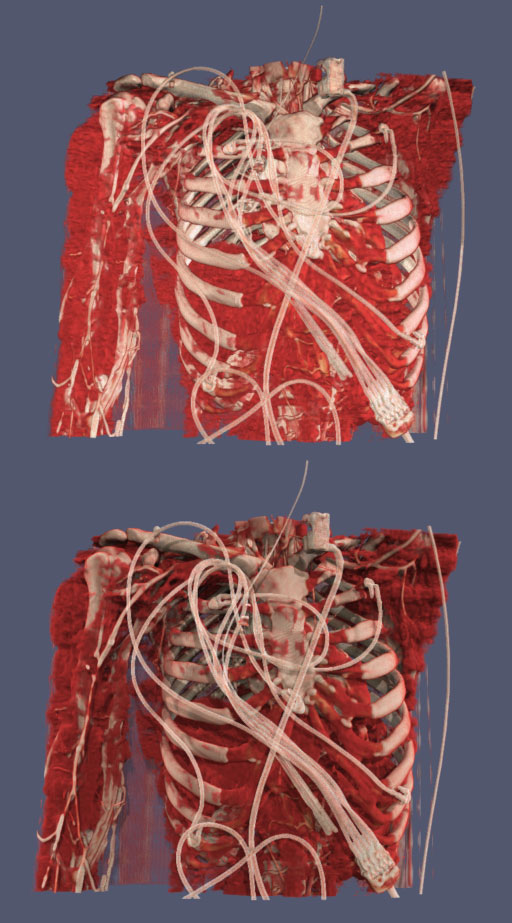 ParaView (Medical edition), how to import files ParaView (Medical edition), offline repository setup for resilient backups