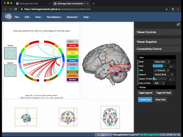 BioImage Suite Web, how to import files BioImage Suite Web, offline repository setup for resilient backups